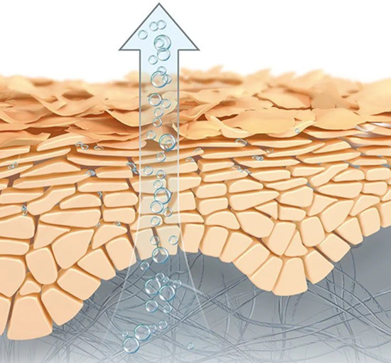 Xerosis – Symptoms, causes and solutions