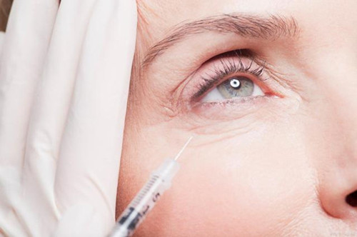 The Path and Method of Collagen Filler Entering the International Market